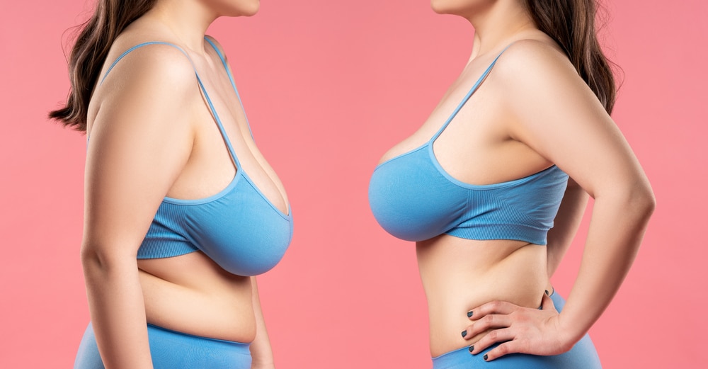 Does Collagen Help Breast Growth?